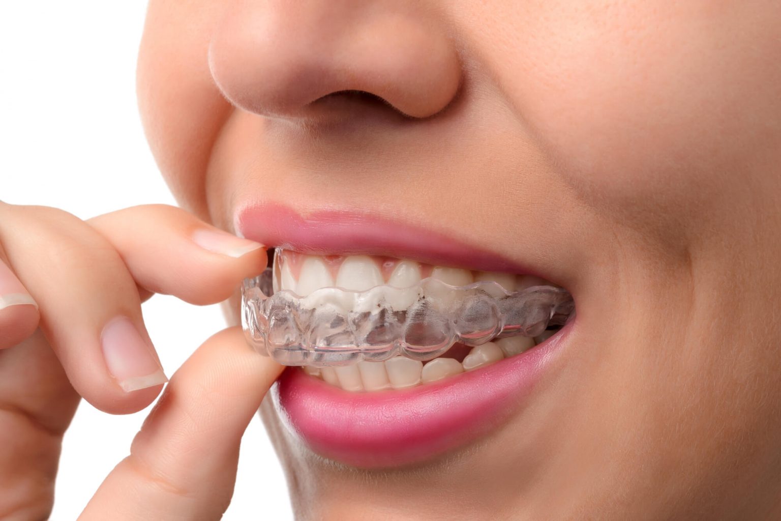 Where can I get Invisalign Oak Park?