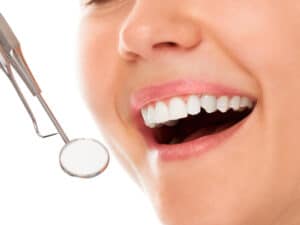 Teeth Whitening in Oak Park