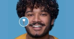 Dental Implants in Oak Park - Restoring Facial Aesthetics - One Fine Smile