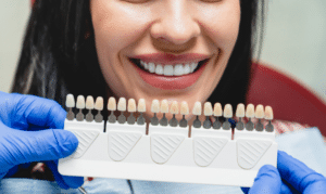 Transform Your Smile with Veneers- Fix Chips, Gaps, Discoloration