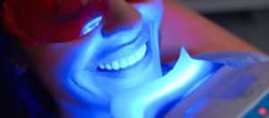 Can I Drink Alcohol After Teeth Whitening